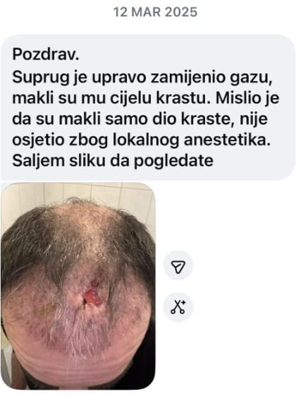 Poruka od 12.03.2025. sa fotografijom rane nakon uklanjanja kraste
